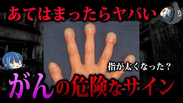 【ゆっくり解説】あてはまったらすぐに病院に！知らないとヤバイがんのサイン５選