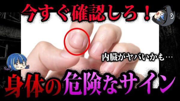 【ゆっくり解説】絶対に確認して！本当に怖い身体の危険なサイン５選