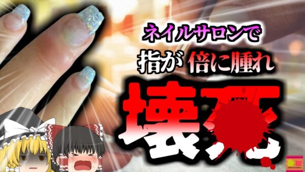 【2019年】ネイルサロンで負った小さな傷から感染症にかかり　指が倍に腫れ壊〇　患部を切除する重症に【ゆっくり解説】