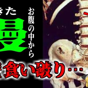 【2020年】「便秘に効くよ」→お尻に40センチのウナギを入れた男性 ｜腸を食い破られて危篤状態に|危険な民間療法と迷信【ゆっくり解説】