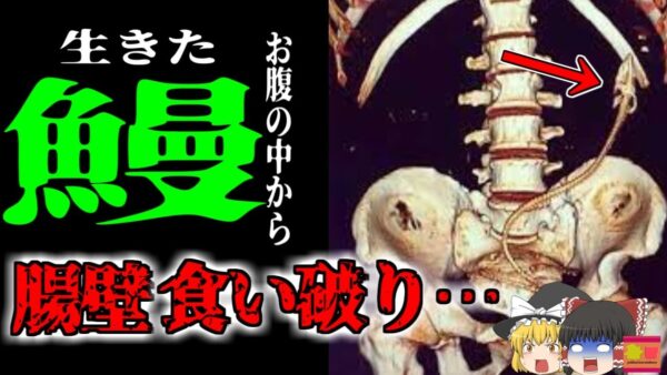 【2020年】「便秘に効くよ」→お尻に40センチのウナギを入れた男性 ｜腸を食い破られて危篤状態に|危険な民間療法と迷信【ゆっくり解説】