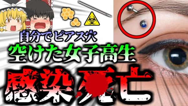 【2021年】「お金ないし自分でピアス空けよ。」→感染症にかかり敗血症で◯亡　どこにでもいる細菌と傷の危険　【ゆっくり解説】