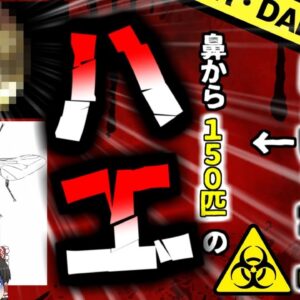 【2024年】鼻から150匹のハエ　手を洗わなかったばっかりに『蝿蛆症』に罹った男性【ゆっくり解説】