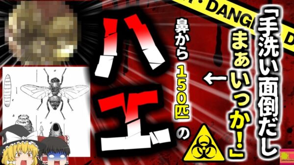 【2024年】鼻から150匹のハエ　手を洗わなかったばっかりに『蝿蛆症』に罹った男性【ゆっくり解説】