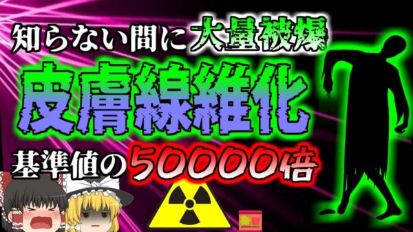 【1996年】皮膚が線維化し脳が壊4 病院の杜撰な管理で100人以上が大量被爆 『コスタリカ放射線治療施設被曝事故』【ゆっくり解説】（加筆修正版）