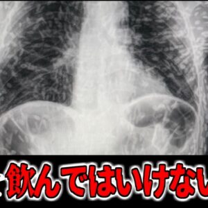 【2014年】生水を飲んではいけない理由 原因不明の咳で受診した男性 レントゲンに映った無数の『白い影』　身体が寄生虫だらけになる恐ろしい『テニア症』【ゆっくり解説】