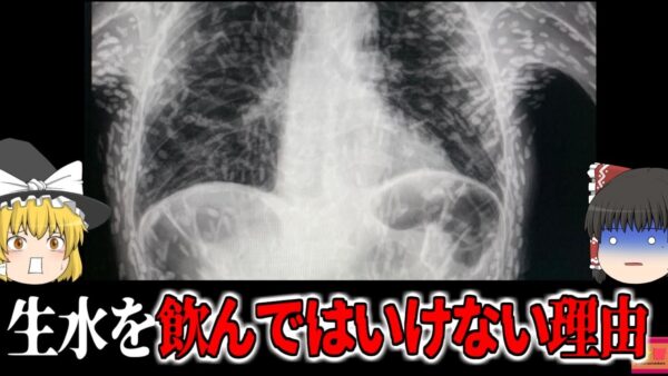 【2014年】生水を飲んではいけない理由 原因不明の咳で受診した男性 レントゲンに映った無数の『白い影』　身体が寄生虫だらけになる恐ろしい『テニア症』【ゆっくり解説】