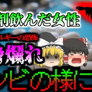 【2020年】市販薬で全身がゾンビの様になってしまった女性 原因はどこにでも売っている『痛み止め薬』薬物アレルギーで命の危機に 【ゆっくり解説】