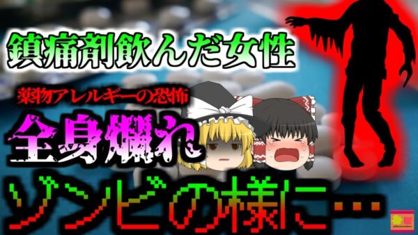 【2020年】市販薬で全身がゾンビの様になってしまった女性 原因はどこにでも売っている『痛み止め薬』薬物アレルギーで命の危機に 【ゆっくり解説】