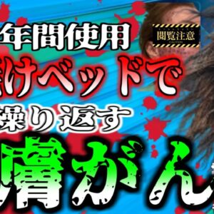 【2020年】「日焼けしただけ…」14歳から15年間日焼ベッドを使用した女性 皮膚癌である『メラノーマ』発症で怯えて暮らすことに…【ゆっくり解説】