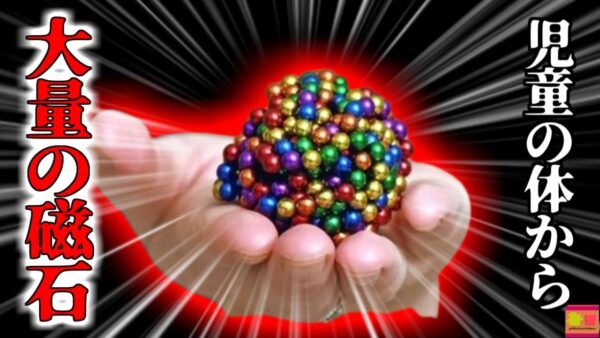 【2021年】腸から64個のおもちゃ摘出 子供用おもちゃのマグネットで腸を切除 『ネオジウム磁石誤飲事故』【ゆっくり解説】