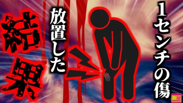 【2018年】川でカニ捕りをしていた男性 謎の体調不良で足が真っ黒に変色 地獄の苦しみを味わった末やむなく切断…『人食いバクテリア壊○筋膜炎』【ゆっくり解説】