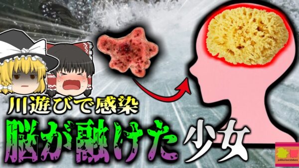 【2016年】夏に川遊びをしていた女子高生 帰宅後風邪のような症状が現れ昏睡 緊急搬送されるも〇亡 脳を調べてみると組織が…温かい自然の水に潜む『人喰い細菌』【ゆっくり解説】