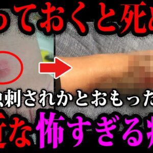 【ゆっくり解説】放って置いたら●にます。身近に存在する怖すぎる病気５選