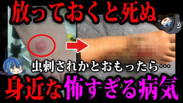【ゆっくり解説】放って置いたら●にます。身近に存在する怖すぎる病気５選