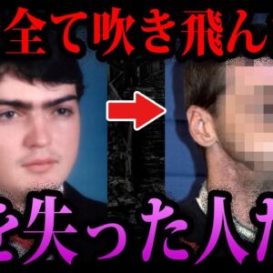 【ゆっくり解説】些細な喧嘩で顔が吹きとんだ…顔を失った人たち５選