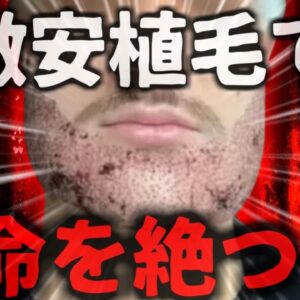 【2024年】『お！安く施術受けられるな』→トルコの激安髭移植を受けた男性 実は医師ではなく全くの素人に施術され絶命する【ゆっくり解説】