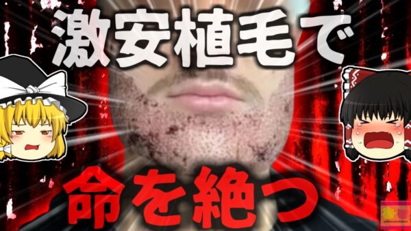 【2024年】『お！安く施術受けられるな』→トルコの激安髭移植を受けた男性 実は医師ではなく全くの素人に施術され絶命する【ゆっくり解説】