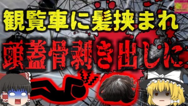 【2024年】『頭皮が全て剥がれた』お祭り中、観覧車に長い髪の毛を巻き込まれた少女 頭皮が丸ごと剥がれる重傷を負い危篤状態に…【ゆっくり解説】