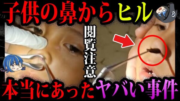 【ゆっくり解説】どうしてそこからソレが…本当にあったヤバすぎ事件５選