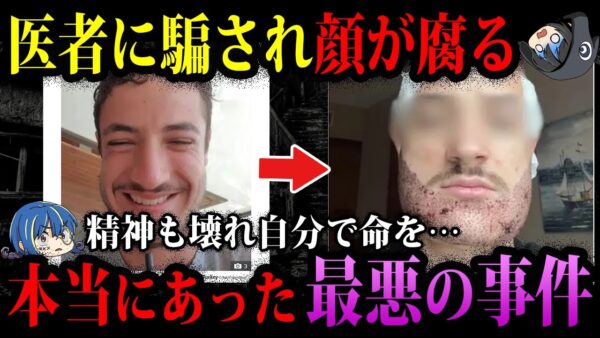 【ゆっくり解説】医者に騙され心も壊れた…本当にあった最悪の事件６選