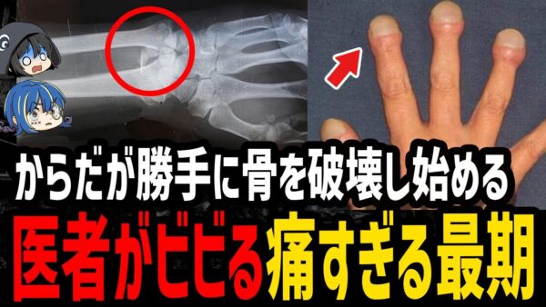 【ゆっくり解説】●●が痛み出したらもう手遅れ。医者が明かした痛い最期５選