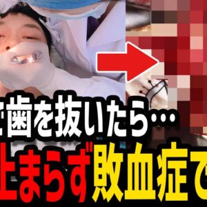【ゆっくり解説】歯を抜いただけなのに…本当にあった最悪の死因３選