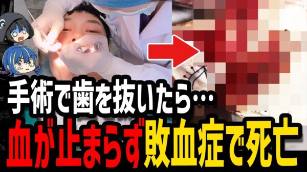 【ゆっくり解説】歯を抜いただけなのに…本当にあった最悪の死因３選