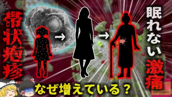 【2025年】『痛すぎて一睡もできない』特定の世代で増えつつある「帯状疱疹」とは　なぜ今になって？予防方法は？水ぼうそうを発症したことがある人は要注意 【ゆっくり解説】