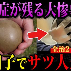 【ゆっくり解説】泥団子でサツ人未遂！？本当にあったありえないものが凶器になった事件