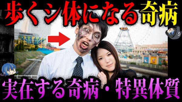 【ゆっくり解説】私はすでにシんでいる。実在する奇病・特異体質