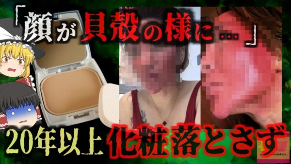 『化粧落とさず顔が貝殻の様に』20年以上ほとんど化粧を落とさなかった結果、化学性刺激で重度皮膚炎に…化粧落としの重要性【ゆっくり解説