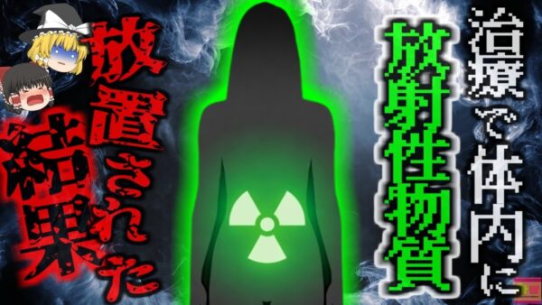 医師『機械に安全って表示されたし大丈夫だろ』→患者の体内にイリジウムを落としたことに気が付かず大量被曝　通常の1000倍放射線で患者が壊死…『インディアナ地域がんセンター放射線事故』【ゆっくり解説】