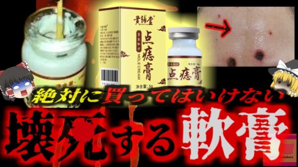 『輸入軟膏塗ったら顔が壊死した』ホクロが取れると謳った動画広告の中国製軟膏 その中身は肉を溶かす強アルカリ性…使用者が次々と皮膚壊死を引き起こす大惨事に…『点痣膏事件』【ゆっくり解説】