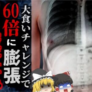 『食べ放題だし元取らないと…』→ビュッフェで無理やり10kg近く食べた男性 胃が通常の60倍に膨張し壊死し死亡…『長沙市食べ放題死亡事故』【ゆっくり解説】