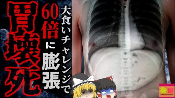 『食べ放題だし元取らないと…』→ビュッフェで無理やり10kg近く食べた男性 胃が通常の60倍に膨張し壊死し死亡…『長沙市食べ放題死亡事故』【ゆっくり解説】