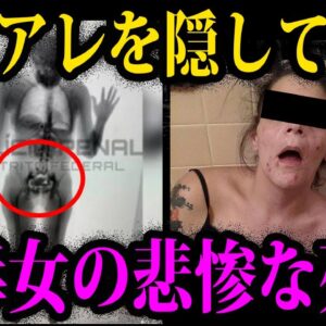 【ゆっくり解説】体のアソコにアレを隠した末路…本当にあったありえない死因