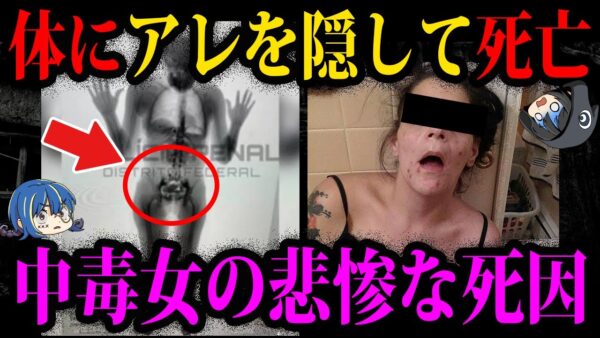 【ゆっくり解説】体のアソコにアレを隠した末路…本当にあったありえない死因