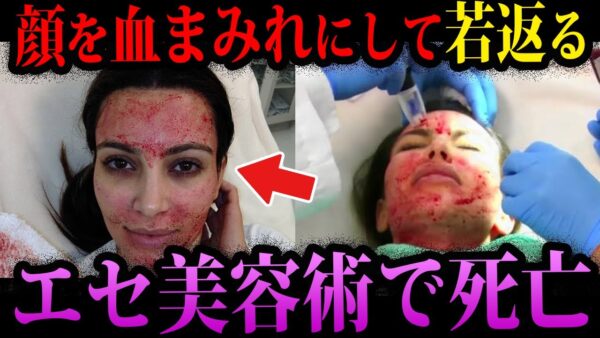 【ゆっくり解説】エセ美容法で死亡。本当にあったありえない死因